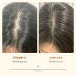 SERUM COREANO CRECIMIENTO