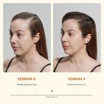 SERUM COREANO CRECIMIENTO