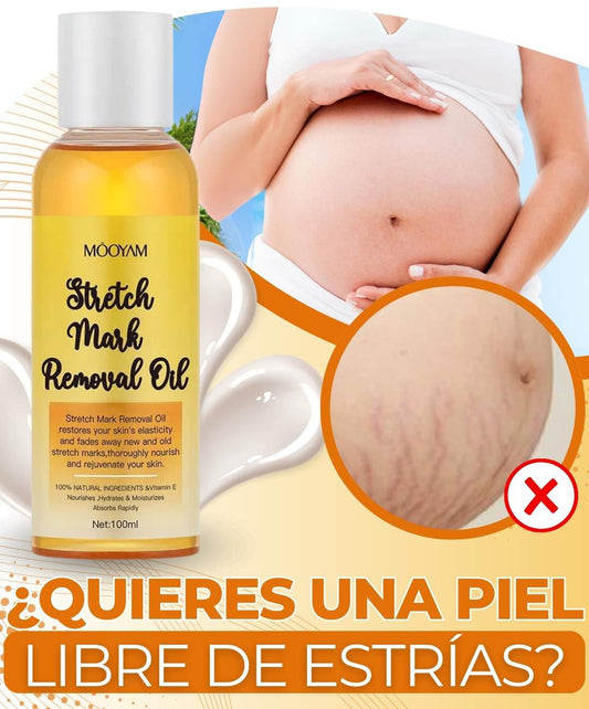 Aceite Eliminador de Estrías PureSkin™